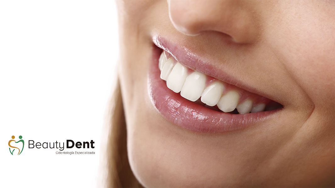 ¿Qué es el diseño de sonrisa?