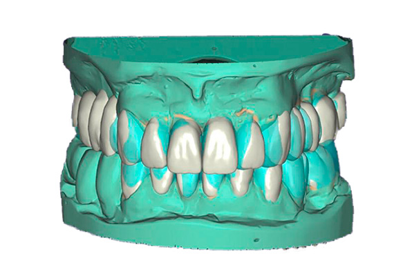 rehabilitacion-oral-02