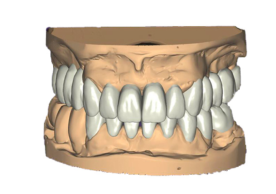 rehabilitacion-oral-03