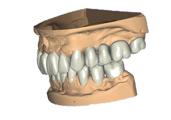 rehabilitacion-oral-04