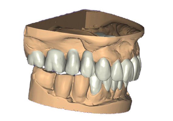 rehabilitacion-oral-05